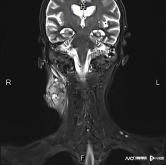 image-20240109103846-1